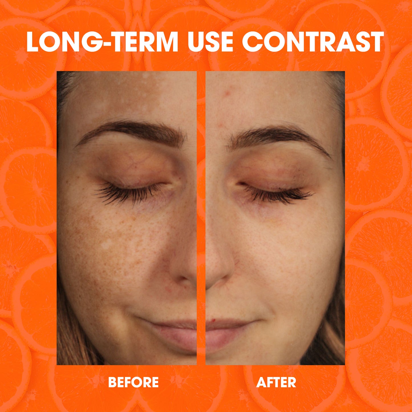SELIRXY Vitamin C Serum for Face, Skin Care Anti Aging Serum, Remedy for Dark Spots Correcting Glow Serum, Even Skin Tone, Eye Area, Fine Lines & Wrinkles, 1 Fl Oz