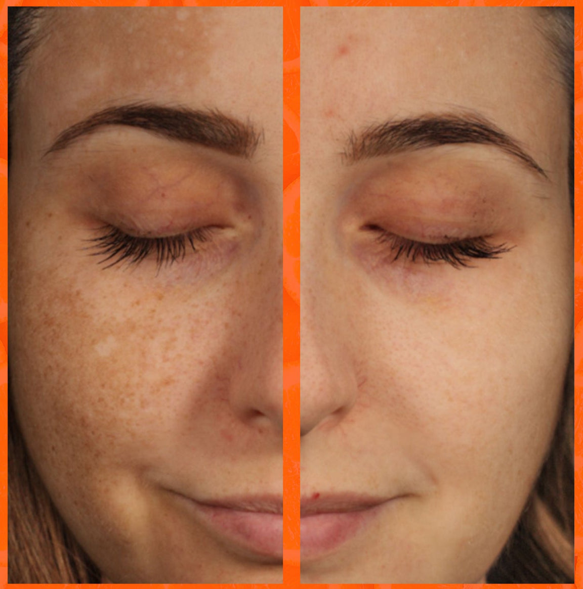 SELIRXY Vitamin C Serum for Face